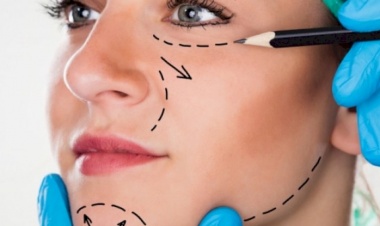 Estetik Ameliyatlarda Doktorların Sorumluluğu Nedir? Estetiğim istediğim gibi olmazsa ne yapabilirim ?